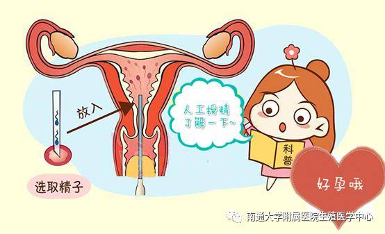 产后私密部位松弛