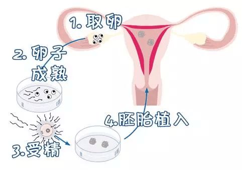 男性不孕不育