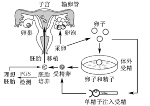 男性不孕不育