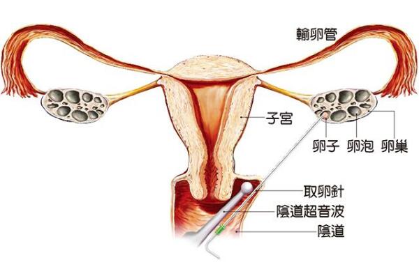 产后心理