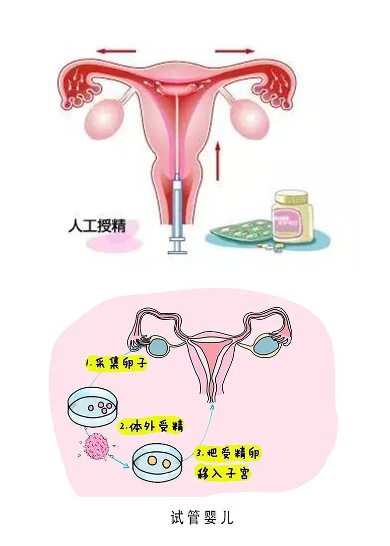 生育能力差