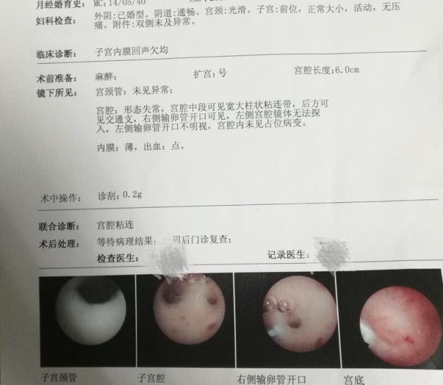 着床出血