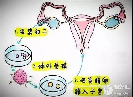 着床出血