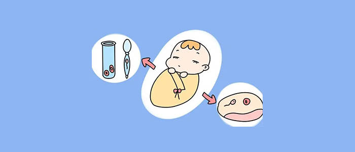 着床出血