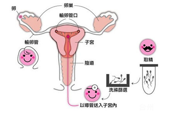 深圳试管婴儿技术